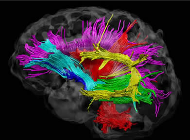 Brain image.